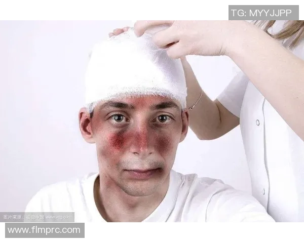 足球比赛中脸部受伤的风险分析与预防措施探讨 足球比赛中脸部受伤的风险分析与预防措施探讨